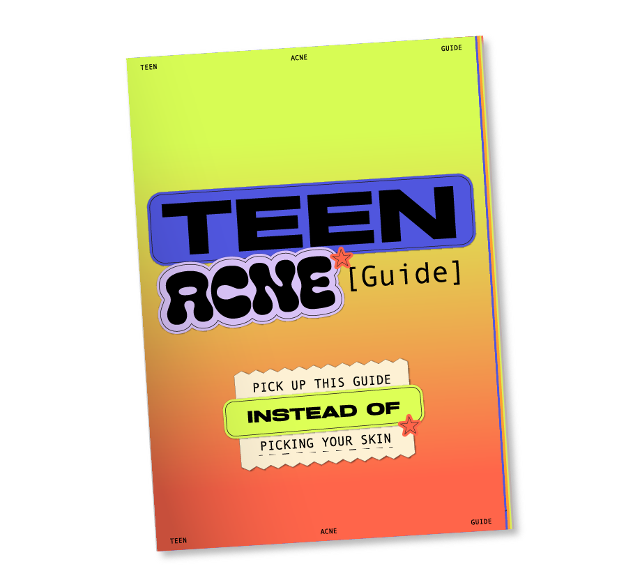 James Vivian Teen Acne Guide